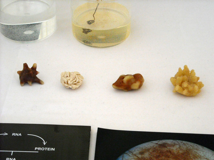 Виды почечных камней описание фото