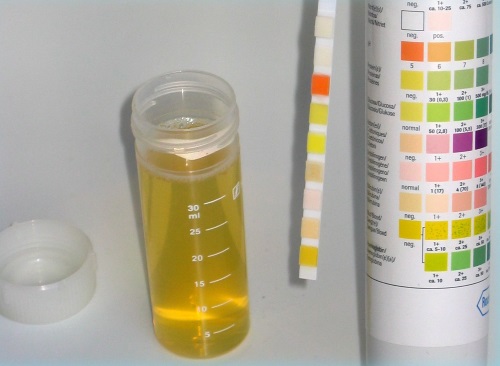 Принцип работы Тест полоски для определения сахара в моче