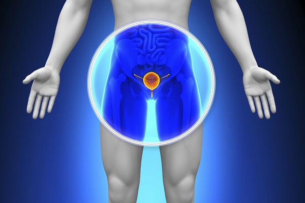 Влияние удаления аденомы простаты на потенцию