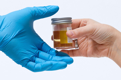 Общий (клинический) анализ мочи