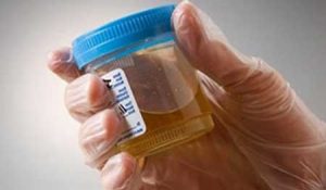 Бактерии в анализе мочи