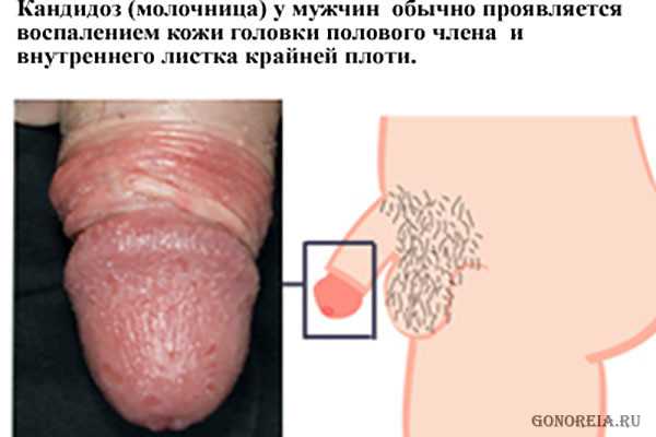 urologicheskie_zabolevaniya_simptomy_i_lechenie_u_muzhchin_1.jpg