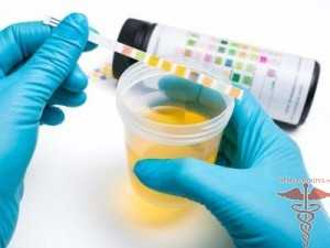lejkotsitarnaya-esteraza-v-moche-u-rebenka-chto-eto-znachit-i-pochemu-uvelichivayutsya-pokazateli5c5c06c1081c5.jpg