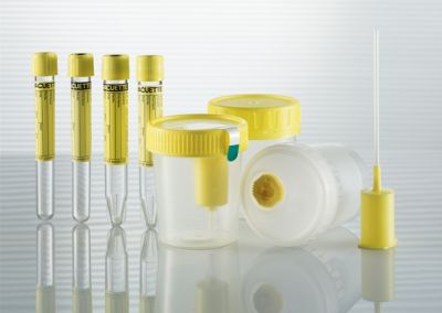 Как правильно сдавать посев мочи при беременности