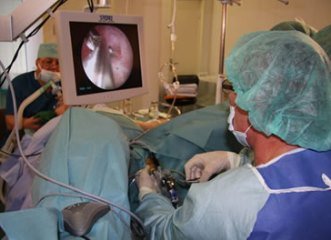 Операция ТУР мочевого пузыря в Израиле трансуретральная резекция мочевого пузыря