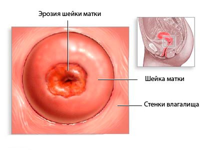 как выглядит патология
