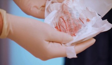 как выглядит кровь