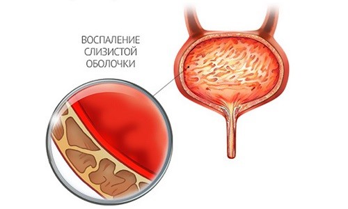 как выглядит заболевание