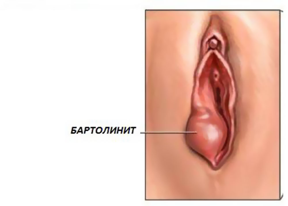 как выглядит заболевание