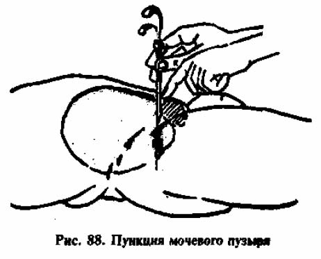 схема проведения процедуры
