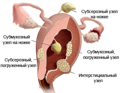 виды патологий
