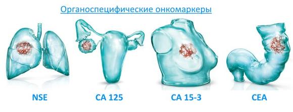 виды онкомаркеров