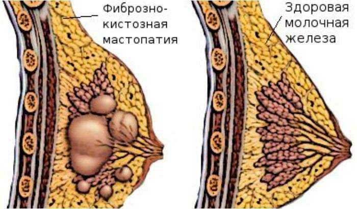 как выглядит заболевание