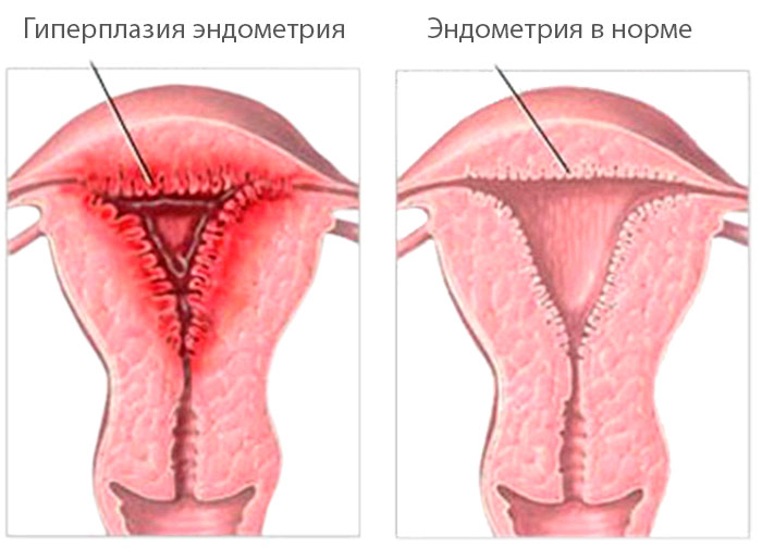 как выглядит патология