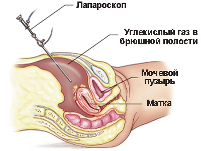 схема проведения операции