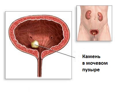 как выглядит патология
