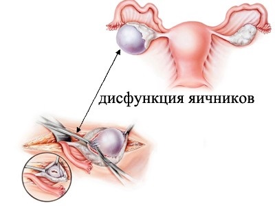 как выглядит дисфункция