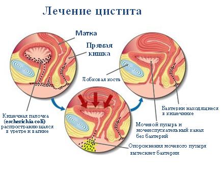 схема лечения заболевания