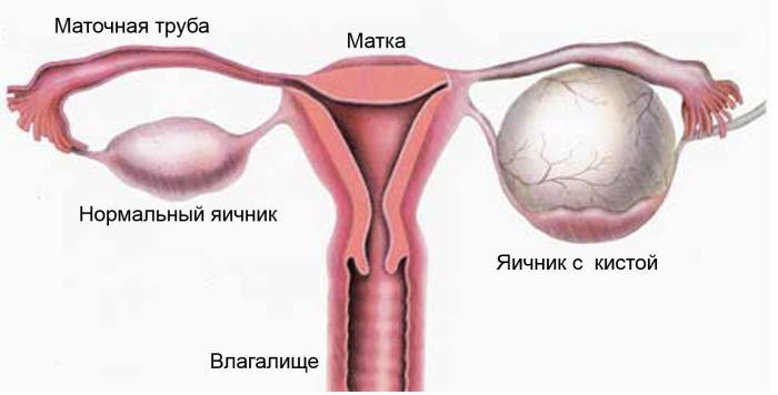 как выглядит заболевание