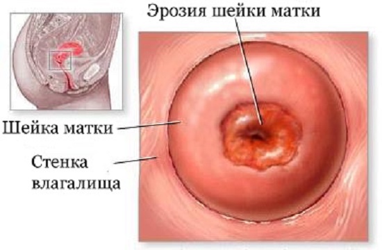 внешний вид заболевания