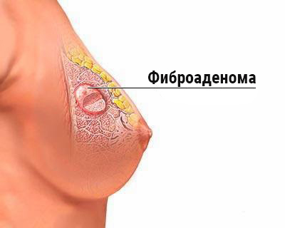 как выглядит заболевание