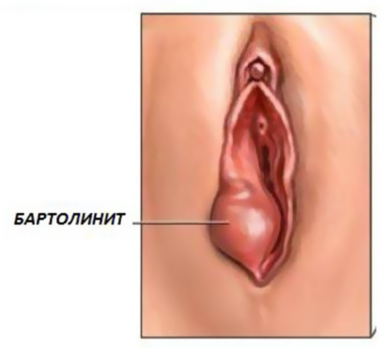 внешний вид заболевания