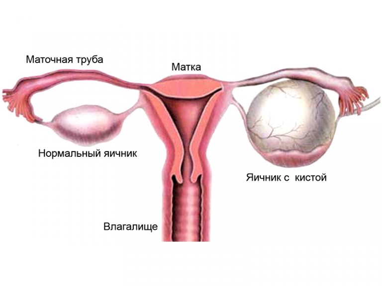 как выглядит заболевание