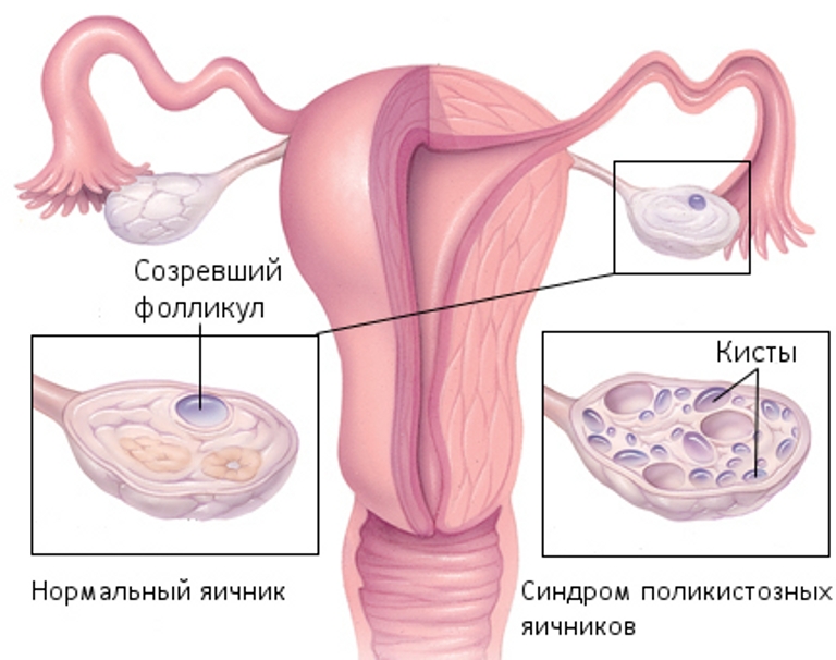 схема появления болезни