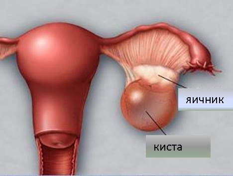 как выглядит заболевание