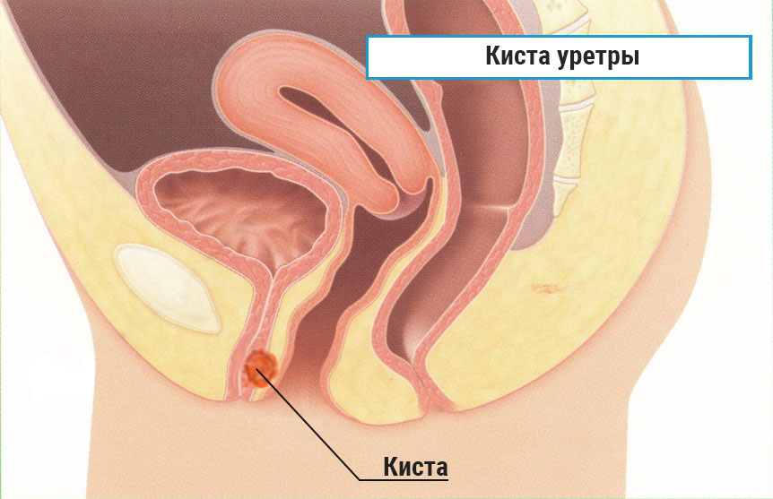 как выглядит заболевание