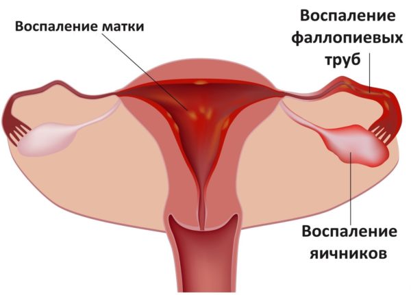причины боли